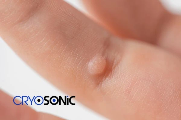 Contact Cryosonic today to learn more about us Huntingdon now! Huntingdon
