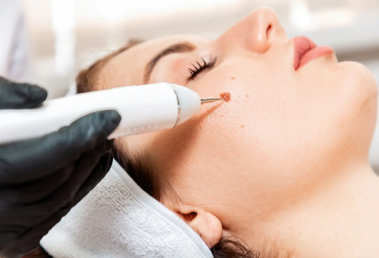 Frequently Asked Questions About Multiple Cryotherapy Treatments Huntingdon