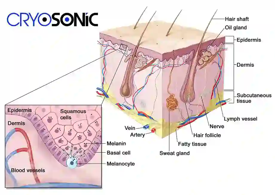 How Cryotherapy Stimulates Melanocyte Activity  Huntingdon